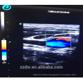 High end trolley type 4d color doppler with volume probe